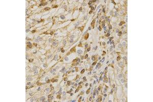 Immunohistochemistry (IHC) image for anti-BCL2-Antagonist/killer 1 (BAK1) (AA 62-112) antibody (ABIN3020677)