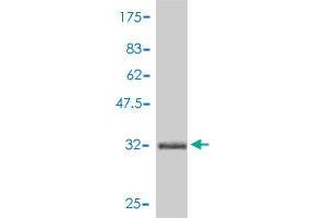 Western Blotting (WB) image for anti-S100 Calcium Binding Protein A8 (S100A8) (AA 1-93) antibody (ABIN562779)