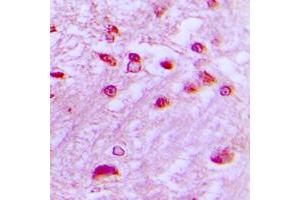 Immunohistochemical analysis of DYRK1A staining in human brain formalin fixed paraffin embedded tissue section. (DYRK1A antibody  (N-Term))