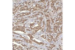 IHC analysis of U1A/SNRPA using anti-U1A/SNRPA antibody (ABIN7600891). (SNRPA1 antibody  (AA 25-218))