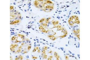 Immunohistochemistry of paraffin-embedded Human stomach using CYP2E1 Polyclonal Antibody at dilution of 1:100 (40x lens). (CYP2E1 antibody)