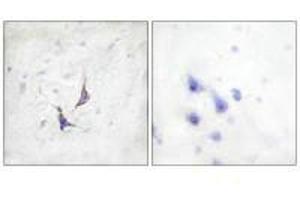 Immunohistochemistry analysis of paraffin-embedded human brain tissue using Syndecan4 (Ab-179) antibody.