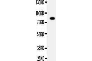 Anti-ADAM2 antibody, Western blotting WB: SMMC Cell Lysate