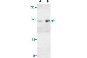 Western blot analysis of BCAP29 in human heart tissue lysate with BCAP29 polyclonal antibody  at (A) 1 and (B) 2 ug/mL . (BCAP29 antibody  (Internal Region))
