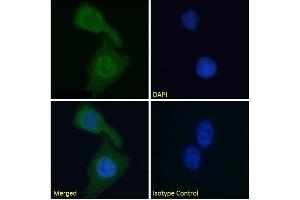 Immunofluorescence staining of fixed HeLa cells with anti-Cardiac Troponin I antibody scFv 180. (Recombinant TNNI3 antibody)