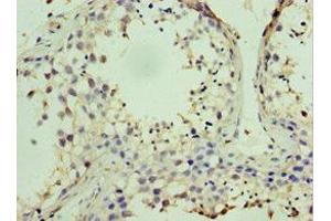 Immunohistochemistry of paraffin-embedded human testis tissue using ABIN7169001 at dilution of 1:100 (STK38 antibody  (AA 1-200))