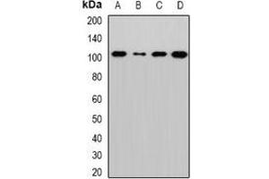 Western blot analysis of Sec5 expression in MCF7 (A), Hela (B), mouse lung (C), rat brain (D) whole cell lysates.