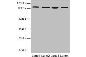 Western blot All lanes: ITGB7 antibody at 5. (Integrin beta 7 antibody  (AA 1-140))