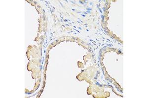 Immunohistochemistry of paraffin-embedded human prostate using B2M antibody. (beta-2 Microglobulin antibody)