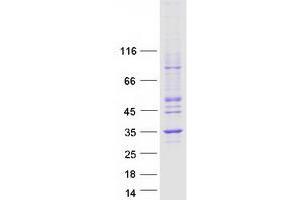 Western Blotting (WB) image for Nucleotide Binding Protein 2 (NUBP2) protein (Myc-DYKDDDDK Tag) (ABIN2727686)