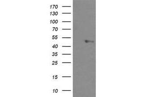 Image no. 1 for anti-U-Box Domain Containing 5 (UBOX5) (AA 1-130), (AA 419-487) antibody (ABIN1490572) (UBOX5 antibody  (AA 1-130, AA 419-487))
