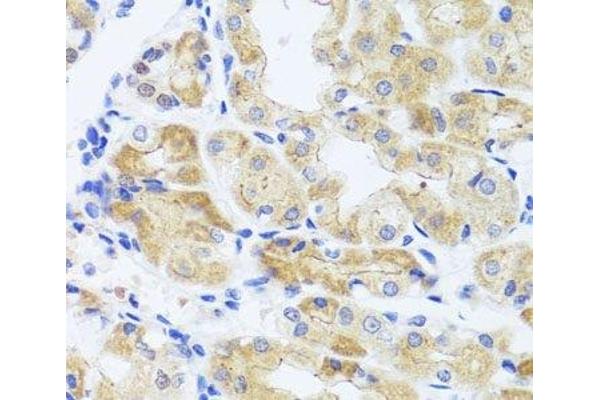 PATJ antibody