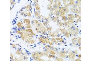 Immunohistochemistry of paraffin-embedded Human stomach using INADL Polyclonal Antibody at dilution of 1:100 (40x lens).