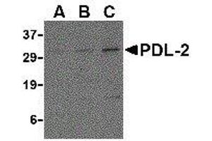 Western Blotting (WB) image for anti-Programmed Cell Death 1 Ligand 2 (PDCD1LG2) (Center) antibody (ABIN2479600) (PDCD1LG2 antibody  (Center))