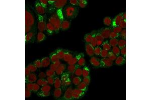 Immunofluorescence Analysis of Human MCF-7 cells labeling RCAS1 with RCAS1 Mouse Monoclonal Antibody (CPTC-EBAG9-1) followed by Goat anti-Mouse IgG-CF488 (Green). (RCAS1 antibody)