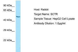 Western Blotting (WB) image for anti-Secretin Receptor (SCTR) (N-Term) antibody (ABIN2790165) (SCTR antibody  (N-Term))