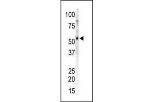 The anti-CK2 gma C-term Pab (ABIN391313 and ABIN2837968) is used in Western blot to detect CK2 gma in mouse heart tissue lysate. (CAMKII gamma antibody  (C-Term))