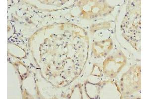 Immunohistochemistry of paraffin-embedded human kidney tissue using ABIN7166892 at dilution of 1:100 (PYCR2 antibody  (AA 2-320))
