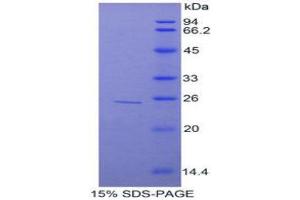 SDS-PAGE (SDS) image for TNFAIP3 Interacting Protein 2 (TNIP2) (AA 20-200) protein (His tag) (ABIN2127130)