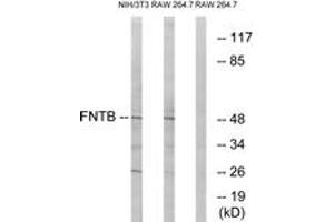 Western blot analysis of extracts from RAW264. (FNTB antibody  (AA 255-304))
