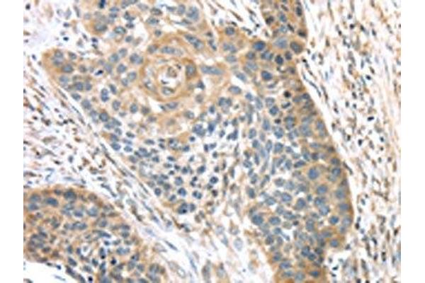 TMPRSS11A antibody