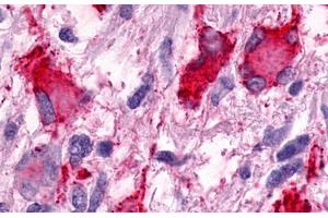 Image no. 2 for anti-G Protein-Coupled Receptor 25 (GPR25) (N-Term) antibody (ABIN1048783) (GPR25 antibody  (N-Term))