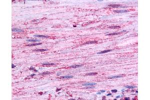 Anti-BDKRB1 antibody IHC of human smooth muscle. (BDKRB1 antibody  (Extracellular Domain))