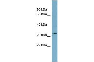 WB Suggested Anti-MGC4172 Antibody Titration:  0. (MGC4172 (Middle Region) antibody)