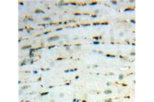 Used in DAB staining on fromalin fixed paraffin-embedded Heart tissue (CCL26 antibody  (AA 24-94))