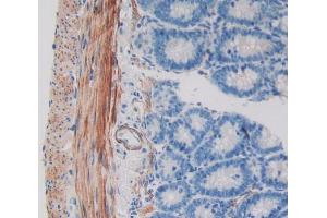 Used in DAB staining on fromalin fixed paraffin- embedded intestine tissue (WIF1 antibody  (AA 38-247))