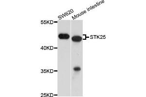 Western blot analysis of extract of SW620 and mouse intestine cells, using STK25 antibody.