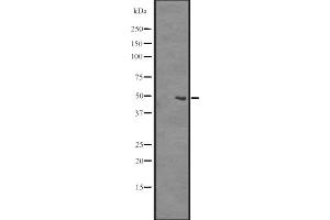 Western blot analysis of SLC35B2 expression in A375 cell line lysates ;,The lane on the left is treated with the antigen-specific peptide. (SLC35B2 antibody  (C-Term))