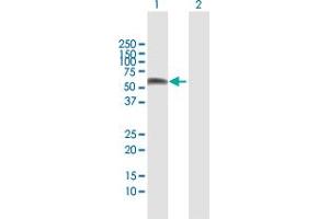 Western Blot analysis of SPN expression in transfected 293T cell line by SPN MaxPab polyclonal antibody. (CD43 antibody  (AA 1-400))