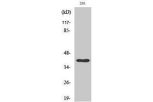 Western Blotting (WB) image for anti-Cathepsin H (CTSH) (Internal Region) antibody (ABIN3181793)