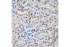 Immunohistochemistry (IHC) image for anti-Mdm2, p53 E3 Ubiquitin Protein Ligase Homolog (Mouse) (MDM2) (AA 130-230) antibody (ABIN3020951)