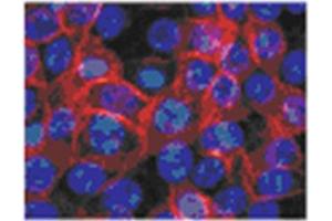Human epidermal keratinocytes from neonatal foreskin stained in Immunofluorescence with TGM1 antibody Cat.