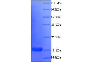 Synaptosomal-Associated Protein 91 (SNAP91) (AA 2-149) protein (His tag)