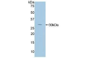 Detection of Recombinant IkBd, Human using Polyclonal Antibody to Inhibitory Subunit Of NF Kappa B Delta (IkBd) (IkBd antibody  (AA 46-285))