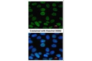 ICC/IF Image Immunofluorescence analysis of paraformaldehyde-fixed Human ESC, using SOX2, antibody at 1:100 dilution. (SOX2 antibody)