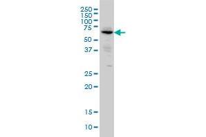 ALPI monoclonal antibody (M03), clone 3A8 Western Blot analysis of ALPI expression in HeLa . (Intestinal Alkaline Phosphatase antibody  (AA 74-162))