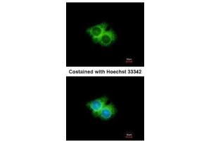 ICC/IF Image Immunofluorescence analysis of methanol-fixed Hep G2, using GPR62, antibody at 1:500 dilution. (GPR62 antibody  (N-Term))