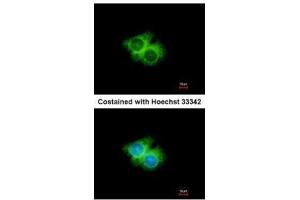 ICC/IF Image Immunofluorescence analysis of methanol-fixed Hep G2, using GPR62, antibody at 1:500 dilution.