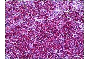 Human Spleen: Formalin-Fixed, Paraffin-Embedded (FFPE) (Neurofibromin 1 antibody  (Internal Region))