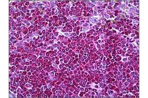 Human Spleen: Formalin-Fixed, Paraffin-Embedded (FFPE) (Neurofibromin 1 antibody  (Internal Region))