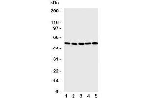 Western blot testing of SMAD1 antibody and Lane 1:  SMMC-7721;  2: K562;  3: HT1080;  4: HeLa;  5: Jurkat cell lysate.