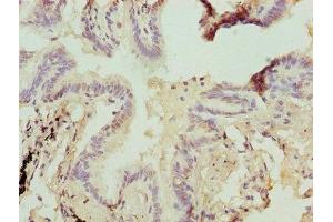 Immunohistochemistry of paraffin-embedded human lung tissue using ABIN7154897 at dilution of 1:100 (HSBP1 antibody  (AA 1-75))