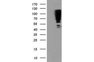 HEK293T cells were transfected with the pCMV6-ENTRY control (Left lane) or pCMV6-ENTRY SERPINB13 (Right lane) cDNA for 48 hrs and lysed. (SERPINB13 antibody)