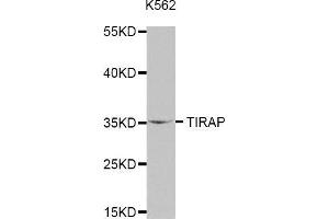Western blot analysis of extracts of K562 cell line, using TIRAP antibody. (TIRAP antibody  (AA 1-221))