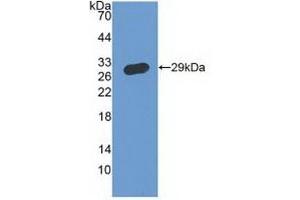 Detection of Recombinant IFNgR1, Human using Polyclonal Antibody to Interferon Gamma Receptor 1 (IFNgR1) (IFNGR1 antibody  (AA 18-245))