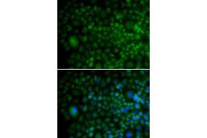 Immunofluorescence analysis of U20S cell using ANG antibody. (ANG antibody  (AA 25-147))